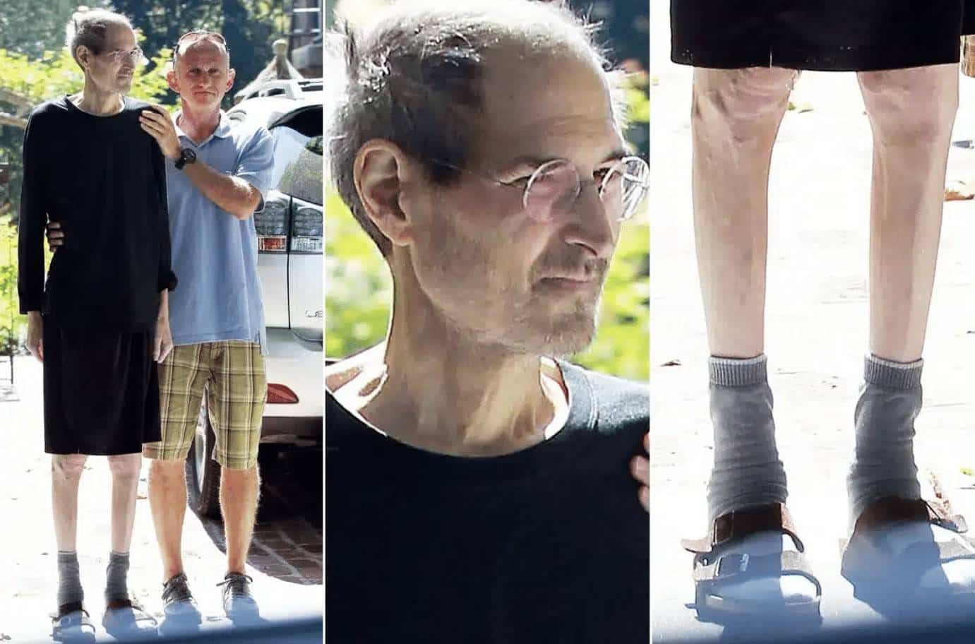 Steve chiến đấu với căn bệnh ung thư quái ác